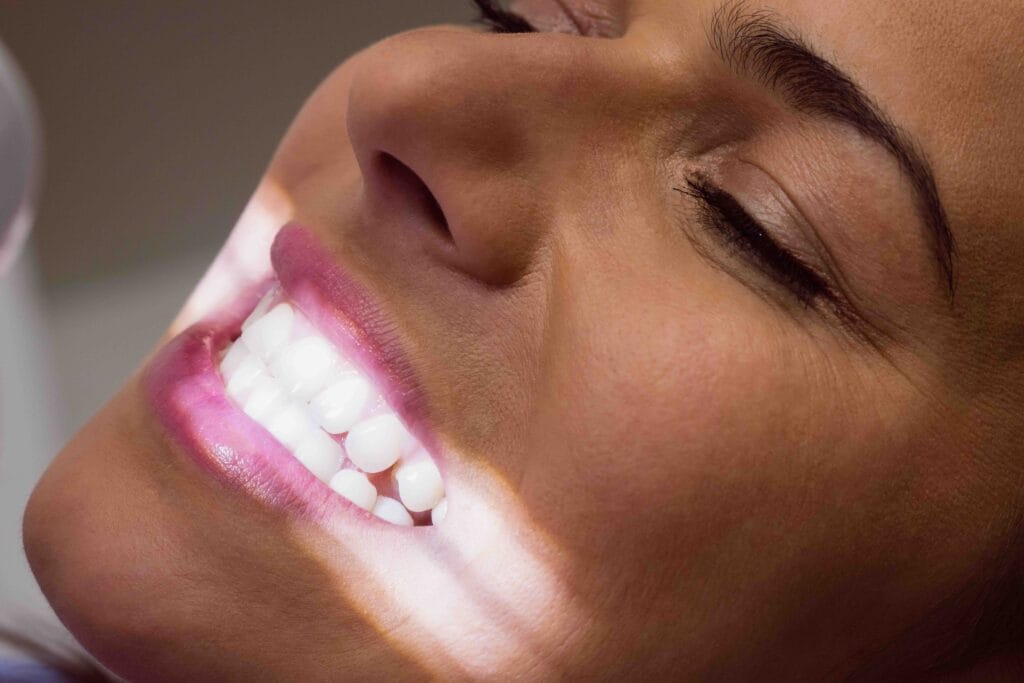 Igiene e sbiancamento dentale