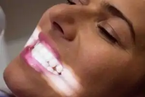 Igiene e sbiancamento dentale
